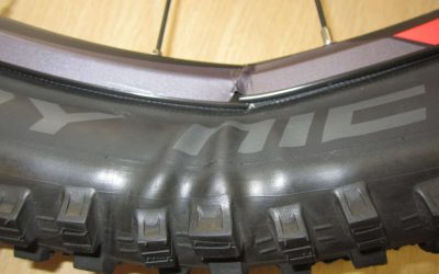 Faulty bicycle injury claim