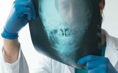 Brain injury due to premature birth claims UK